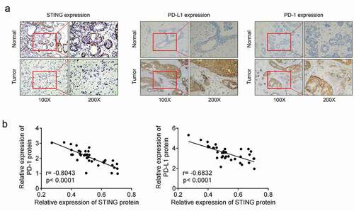 Figure 1. STING was downregulated and PD-1 and PD-L1 were upregulated in BCa tissues (a) Immunohistochemical analysis was performed to detect STING, PD-1 and PD-L1 protein expressions in BCa tissues and paired adjacent normal tissues of patients. (b) Pearson’s correlation analysis was conducted to examine the correlation between STING level and PD-1 or PD-L1 protein levels in BCa tissues. BCa, breast cancer; STING, stimulator of interferon gene; PD-1, programmed cell death; PD-L1, programmed death-ligand 1.