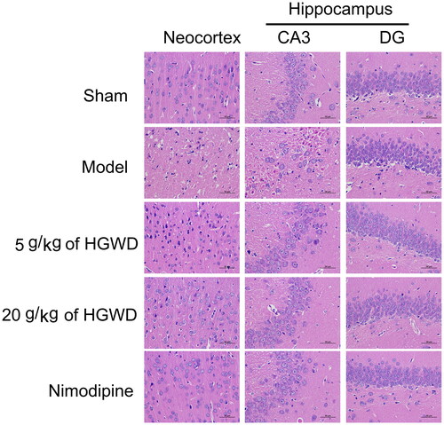 Figure 6. HGWD alleviated neuronal injury. HE staining images of the neocortex and hippocampus. (n = 3, scale bar = 50 μm, 400×).