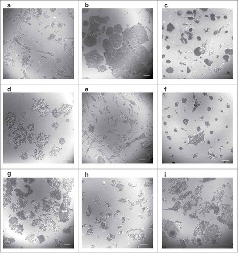 Figure 1. Morphology of contact areas between leukemia cells and fibronectin-coated surface. Leukemia cell lines (a-f) or primary cells from leukemia patients (g-i) were seeded on FN-coated slides and incubated for 1 h at 37°C. The cell parts which are very close to the surface were visualized by interference reflection microscopy. The mean diameter of cells in suspension is 12–16 µm for cell lines and 6–9 µm for primary cells. Scale bars: 10 µm. Characteristic IRM images for leukemia/lymphoma cell lines OCI-AML3 (a), HEL (b), HL-60 (c), K562 (d), MOLM-7 (e), Karpas-299 (f). Primary cells from 3 different patients with AML are shown in (g-i).