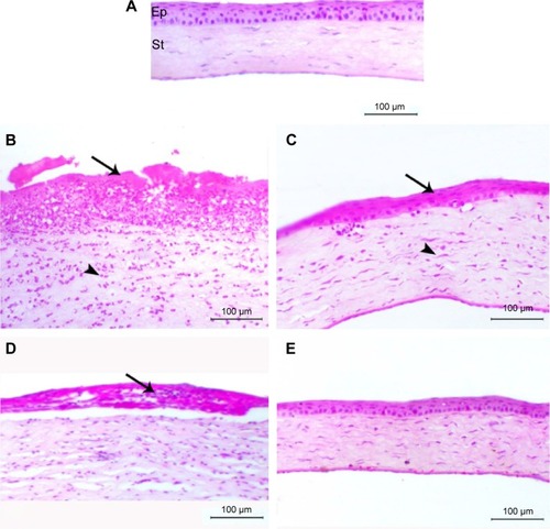 Figure 3 Photomicrograph of corneal sections of normal and diabetic rats treated with AV.