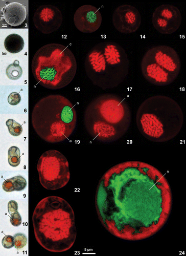 Figs 3–24. Scanning electron, light and confocal laser scanning micrographs of Leonella granifera, Thoracosphaera heimii and Calciodinellum operosum. Figs 3–11. Light and scanning electron micrographs of Leonella granifera. Figs 3–5. strain GeoB*153, well calcified cells that were the dominant life-cycle stage. Figs 6–11. strain GeoB*192, weakly calcified cells showing different stages of binary fission. An orange accumulation body (a) was frequently observed in these cells. Figs 12–24. Confocal laser scanning microscopy images of cells from Thoracosphaera heimii, strain GeoB*101 (Figs 12–15), Leonella granifera, strains GeoB*153 (Figs 16–18) and GeoB*192 (Figs 19–21), and Calciodinellum levantinum, strain GeoB*165 (Figs 22–24), stained with propidium iodide. Nuclei with permanently condensed chromosomes visible in all specimens of T. heimii and L. granifera (Figs 12–21). Chloroplast (c) and propidium iodide fluorescence of the nucleus (n) were distinguished with Leica dye finder software (Figs 13, 16, 19). Cells with two nuclei were frequently observed (Figs 15, 17, 18). Accumulation body (a) observed in weakly growing cultures of L. granifera strain GeoB*192 was autofluorescing (Figs 19, 20). Fig. 22. Small thecate cell of C. levantinum with relatively small nucleus, interpreted to be haploid. Fig. 23. Large thecate cell of C. levantinum with relatively large nucleus, interpreted to be diploid. Fig. 24. Calcareous cyst of C. levantinum that was less well stained, so that chromosomes are not clearly visible; nucleus (n) visualized with Leica dye finder software; because of relatively large size of nucleus, cell also interpreted to be diploid. Scale bars: 5 µm.