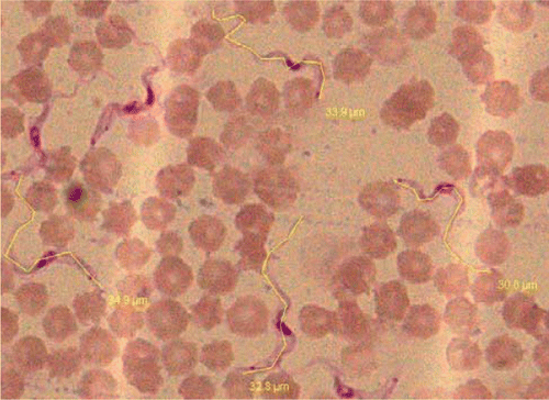 Figure 1.  Blood film showing actively multiplying stages and micrometric measurements of Trypanosma evansi (Giemsa×100X).