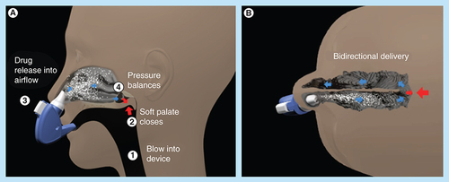 Figure 3. Breath Powered™ Bi-Directional™ nasal delivery concept.Lateral and superior view of the nasal passages illustrating the Breath Powered Bi-Directional nasal delivery concept (see text for more detailed description).Reproduced with permission from [Citation23,Citation132].
