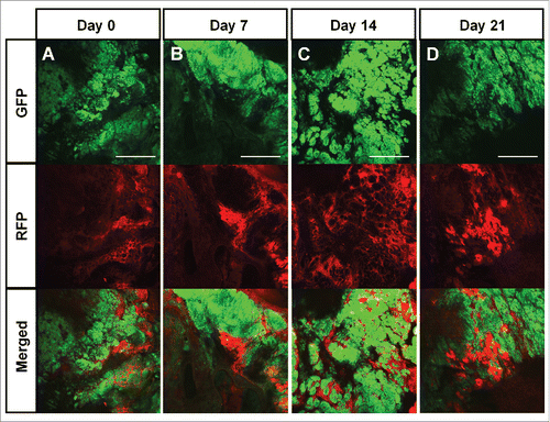 Figure 2. Color-coded real-time intravital cancer-cell/stromal-cell imaging in untreated tumors. Color-coded intravital imaging of a tumor in a control mouse (A-D). Intravital images were obtained weekly. Upper panels show GFP-expressing cancer cells, middle panels show RFP-expressing stromal cells, and lower panels show merged images with GFP and RFP. Scale bars: 1.0 mm.