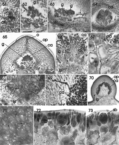 Figs 61–73. Gracilaria multipartita. Cystocarp development and tetrasporangia. Fig. 61. Carpogonial fusion cell that is continuing to enlarge by incorporation of cells of the outer pericarp (arrowheads) (HGI–A 16029). Fig. 62. Portion of a carpogonial fusion cell bearing clusters of young gonimoblast filaments and a tubular nutritive cell (arrow) (HGI–A 16029). Fig. 63. Lobed carpogonial fusion cell bearing clusters of young carposporangial chains and tubular nutritive cells (arrows) issuing from the carpogonial fusion cell and an inner gonimoblast cell (HGI–A 16029). Fig. 64. Transverse section of a young cystocarp composed of expanding inner gonimoblast cells, a tubular nutritive cell (arrow) and clusters of young carposporangia (HGI–A 16029). Fig. 65. Developing cystocarp in a median transverse section showing expanding inner gonimoblast cells, a tubular nutritive cell (arrow), a cluster of carposporangia, and an outer pericarp with an ostiole (HGI–A 16029). Fig. 66. Inner pericarp, expanding, vacuolate gonimoblast cells and branched chains of carposporangia (HGI–A 16029). Fig. 67. Enlarged view of vacuolate inner gonimoblast cells interconnected by numerous secondary pit connections (arrows) (HGI–A 16029). Fig. 68. Enlarged view of inner gonimoblast filaments bearing a row of tubular nutritive cells (arrows) penetrating the lower region of the outer pericarp. Fig. 69. Multinucleate tubular nutritive cell (arrow) penetrating between cells of the outer pericarp and fusing with individual pericarp cells (HGI–A 16029). Fig. 70. Non-median section of a mature cystocarp with vacuolate inner gonimoblast cells, a tubular nutritive cell (arrow), and mature clusters of carposporangia surrounded by inner and outer pericarps (HGI–A 16029). Fig. 71. Scattered tetrasporangia in surface view (arrows) (HGI–A 18008). Fig. 72. Cross-section of a fertile area showing the latero-basal connection between a tetrasporangial initial and a subcortical cell (arrow) (HGI–A 18066). Fig. 73. Mature cruciately divided tetrasporangium surrounded by cortical filaments (HGI–A 18066). Scale bars: Figs 61, 62, 66, 67, 68, 70, 72, 73 = 20 µm; Figs 63, 64, 70 = 50 µm; Figs 65, 69 = 100 µm; Fig. 71 = 200 µm. Figs 61–70, 72, 73 haematoxylin. Abbreviations: ca = carposporangium; cfc = carpogonial fusion cell; g = gonimoblast; ip = inner pericarp; n = nucleus; o = ostiole; op = outer pericarp; sb = side branch.