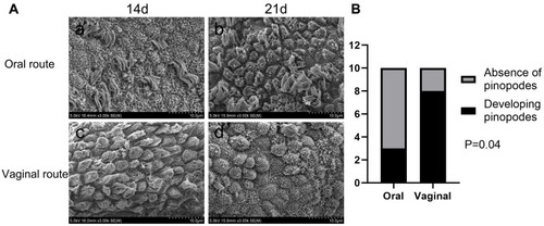 Figure 4 (A) Scanning electron micrograph showing the apical surface of the luminal uterine epithelium in endometrial samples obtained on day 21. Note the absence of pinopodes (a) and the presence of the developing pinopodes (b, c, d). Scale bars = 10μm. (B) Only 3 of the oral group patients showed developing pinopodes on day 21, while 8 patients in the vaginal group were observed (P=0.04). None of them showed fully developed pinopodes. P values are for Chi‑square test.