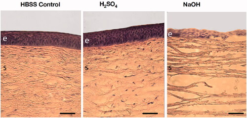 Figure 1. Altered structural integrity of the porcine corneal epithelium and stroma after chemical injury with 1 M H2SO4, or 1 M NaOH when compared to Hanks’ Balanced Salt Solution (HBSS) controls using hemotoxylin and eosin staining. Scale bar 100 µm; e: epithelium; s: stroma.
