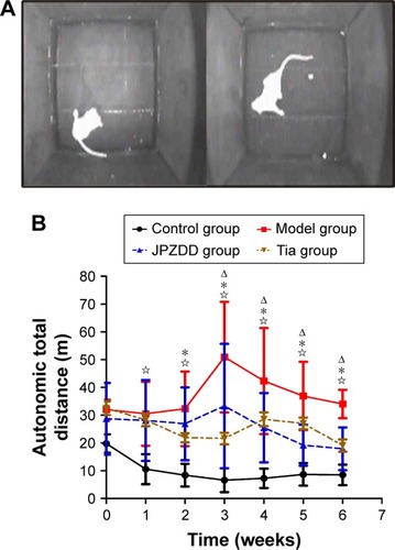 Figure 3 Comparison of autonomic activity after treatment.