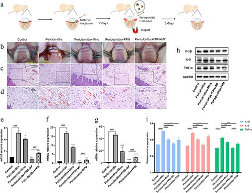 Figure 6 In vivo therapeutic assessment of periodontal inflammation in rat models after treatment. (a) Schematic diagram of the in vivo experiments, including the animal model and local treatment with FPM NPs under magnetic motivation. (b) Intraoral images of model rats after treatment using different nanoparticles. The yellow arrows indicate inflammatory symptoms such as gingival redness, swelling, and bleeding. (c and d) Representative images of periodontal H&E staining from rats after local application of different treatment strategies. The immune cells, such as lymphocytes, neutrophils, macrophages, and monocytes, are indicated by red arrows in (d). (e, f, and g) The relative mRNA levels of pro-inflammatory genes after different treatments. (h and i) The level of pro-inflammatory proteins after different treatments. (Student’s t-test, *, p < 0.05, **, p < 0.01, ***, p<0.001 compared with the periodontitis group, ###, p<0.001 compared with the inter-group comparison).