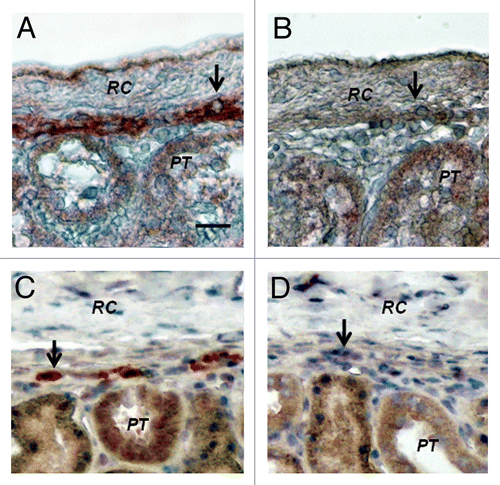 Figure 8. Sections of the islet-implanted kidney from a STZ-diabetic Lewis rat (A and B) or rhesus macaque (C and D) transplanted with E28 pig pancreatic primordia in mesentery followed by porcine islets in the renal subcapsular space stained using anti-insulin antibodies (A and C) or control antiserum (B and D). PT, proximal tubule. RC, renal capsule. Arrows, positively staining cells (A and C); negatively staining cells (B and D). Scale bar 10 um. Reproduced with permission.13,16