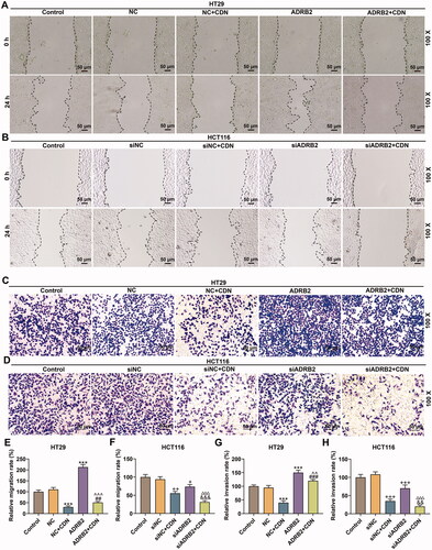 Figure 5. CDN blocked migration and invasion of CRC cells through inhibiting ADRB2 expression. Cells transfected with siADRB2 or ADRB2 overexpression plasmid were exposed to CDN and then examined for the migration and the invasion by wound healing assay (A, B, E and F) and transwell assay (C, D, G and H), respectively. ***p < 0.001 vs. NC; ##p < 0.01 or ###p < 0.001 vs. NC + CDN; ^^p < 0.05 or ^^^p < 0.001 vs. ADRB2; +p < 0.05 or ++p < 0.01 or +++p < 0.001 vs. siNC; &&&p < 0.001 vs. NC + CDN-10; △△△p < 0.001 vs. siADRB2. NC: negative control (empty vector); siNC: negative control of small interfering RNA (siRNA); CDN: cardamonin; CRC: colorectal cancer; ADRB2: β2 adrenergic receptor; siADRB2: small interfering RNA for ADRB2.