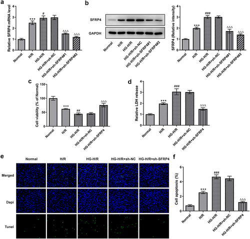 Figure 2. Interference with SFRP4 promotes cell viability of high glucose-stimulated H/R cardiomyocytes cells. (a). Detection of cell interference efficiency after transfection was conducted using RT-qPCR and Western blotting. (b). Cell viability was tested by means of CCK-8 kit. (c). The LDH kit was adopted to detect the release of LDH. (d). Determination of apoptosis levels was implemented with the help of TUNEL. Results are the mean ± SD. ***P < 0.001 versus Normal. #P < 0.05, ##P < 0.01, ###P < 0.001 versus H/R. ΔΔΔP < 0.001 versus HG-H/R + sh-NC.