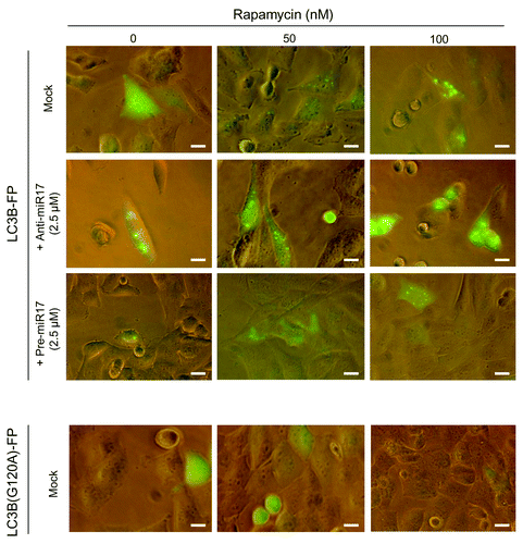 Figure 4. Autophagosomal LC3-FP expression in T98G cells after rapamycin and miR-17 inhibitor/precursor administration. T98G cells are transduced with BacMam LC3B-FP or BacMam LC3B(G120A)-FP viral particles (MOI = 30 each), and after 24 h treated with rapamycin (0−50−100 nM) or transfected with AmiR-17 or PmiR-17 (2.5 µM each). LC3B-FP or LC3B(G120A)-FP expression are analyzed after additional 24h. For DIC phase contrast-fluorescent photographs an inverted microscope (Eclipse TS100, Nikon) with 40× magnification is employed. (Scale bar: 10 μM).