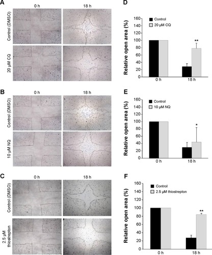 Figure 8 CQ, NQ, and thiostrepton inhibit HuCCT1 cell migration in a wound healing assay.