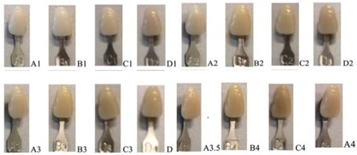 Figure 2 Sixteen types of dental images from the shade guide reference. The VITAPAN classical A1–D4 shade guide (Internationally established dental shade guide commercial product). The arrangement of the shades in the VITAPAN classical family of shades is as follows: A1–A4 (reddish-brownish hue). B1–B4 (reddish-yellowish hue). C1–C4 (greyish hue). D2–D4 (reddish-grey hue). Chroma is designated with numerical values 1, 2, 3, and 4.