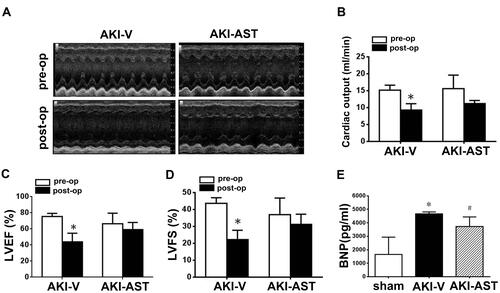 Figure 5 AST-120 administration decreased cardiac dysfunction following renal I/R injury. (A) Echocardiographic images were taken before surgery (pre-op) and 48 h after renal I/R injury (post-op). Representative M-mode echocardiographic tracings (24 min) are presented. (B–D) Data from echocardiograms. n = 6 per group. (E) BNP levels in the plasma from the sham, AKI-V, and AKI-AST groups measured by ELISA. n = 5 per group; the data are expressed as mean ± SEM, *p < 0.05 vs the pre-op group; #p < 0.05 vs the AKI-V group.