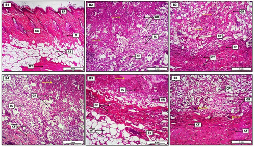 Figure 6 Photomicrograph of skin from groups. (B1) Control group, demonstrates typical morphological arrangement of the epidermis (EP) and dermis (D), with the presence of several sebaceous glands (SG) and a considerable amount of adipose tissues (AT), and some muscle tissue (MT) can be seen within the skin section. (B2) Granuloma positive group, shows the granuloma area (GR) infiltrated with a substantial amount of inflammatory exudate, cells and fluid (yellow arrows). The granuloma is bounded with proliferated fibrous connective tissue (CT) and infiltrated with chronic inflammatory cells (IC). (B3) Granuloma with dexamethasone 1 mg/kg group, reveals apparent reduction in the number of inflammatory cells and exudate (yellow arrows) within the granuloma (GR), which is surrounded with an area of connective tissue (CT) consisting of many proliferated collagen fibers (CF), and the granuloma area shows longitudinal sections of cotton pellet (CP). (B4) Granuloma with aliskiren 15 mg/kg group, shows a significant amount of inflammatory exudate infiltration (yellow arrows), the granuloma (GR) is localized by collagen fiber proliferation (CF) and many inflammatory cells (IC), and epithelioid tissue. (B5) Granuloma with aliskiren 30 mg/kg group, displays significant reduction of inflammatory exudate (yellow arrows) and inflammatory cells (IC), and the granuloma (GR) is encircled with proliferated collagen fibers (CF). The section reveals engorged blood vessel with inflammatory cells (BV) and many numbers of adipocytes (AT). (B6) Granuloma with aliskiren 60 mg/kg group, shows significant reduction in the inflammatory exudate and the size of the granuloma (GR), together with presence of various sections of cotton pellet (CP) within the granuloma area. Multinucleated foreign body giant cells (yellow arrows) can be evident, and increased proliferative amount of collagen fibers (CF) which confined the granuloma. H&E. Scale bars: 4 mm.