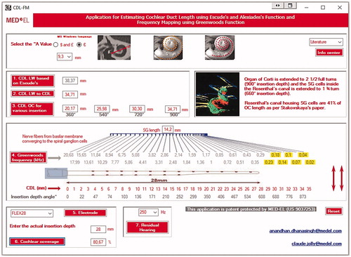 Figure 46. Applying the CDL value in Greenwood’s frequency function would result in patient-individual frequency map. From this map, the starting point of LF residual hearing is possible to identify (image courtesy of MED-EL) [Citation49].