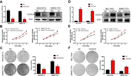 Figure 2 HCC cell proliferation and clonogenicity in vitro facilitated by CCDC34.Notes: (A) The knockdown efficiency of shCCDC34 in the MHCC97-H and SMMC-7721 cell lines measured by the qRT-PCR and Western blot. (B and C) The proliferation ability of the MHCC97-H and SMMC-7721 cells transfected with shCCDC34 or NC lentivirus were detected by the CCK-8 assays (B) and the colony formation assays (C). The “sh” represents the shCCDC34 group and NC stands for the negative control group. (D) The overexpression efficiency of CCDC34 in the BEL-7404 and SMMC-7721 cell lines were measured by the qRT-PCR and Western blot (E and F). The proliferation ability of the BEL-7404 and SMMC-7721 cells transfected with the CCDC34-OE or NC lentivirus were detected by the CCK-8 assays (E) and the colony formation assays (F). The CCDC34 represents the CCDC34-OE group and NC stands for the negative control group. *P<0.05; **P<0.01; ***P<0.001.Abbreviations: HCC, hepatocellular carcinoma; qRT-PCR, quantitative real-time polymerase chain reaction; NC, negative control; CCK-8, Cell Counting Kit-8; OE, overexpression.