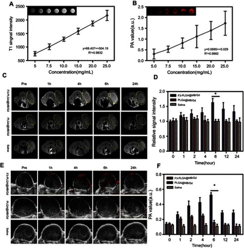 Figure 5 (A)In vitro T1W1 MR images and MRI signal intensities of F3-PLGA@MB/Gd NPs solution at different concentrations (5.0, 10, 15, 20, 25 mg/mL). (B) In vitro PA images and PA values of F3-PLGA@MB/Gd NPs solution at different concentrations (5.0, 10, 15, 20, 25 mg/mL). (C) In vivo T1W1 MR images and the corresponding MRI signal intensities (D) post injection of F3-PLGA@MB/Gd NPs, PLGA@MB/Gd NPs, and saline at different time points (n=3 per group, *P<0.05). (E) In vivo PA images and corresponding PA values (F) Post injection of F3-PLGA@MB/Gd NPs, PLGA@MB/Gd NPs, and saline at different time points (n=3 per group, *P<0.05).Abbreviations: MRI, magnetic resonance imaging; PLGA, poly(lactide-co-glycolic acid); MB, methylene blue; Gd, gadodiamide; NPs, nanoparticles; PA, photoacoustic.