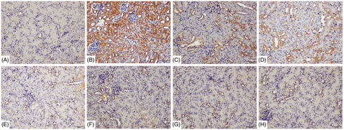 Figure 9. Deposition of Lipocalin-2 on renal tubules using immunohistochemistry detected with DAB kit. (A) Blank control, (B) 72 h TCE+, (C) 72 h B1RA+, (D) 72 h B2RA+, (E) vehicle control, (F) 72 h TCE−, (G) 72 h B1RA−, and (H) 72 h B2RA− group. Magnification =200×. Representative photos are shown.