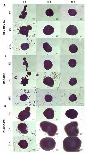 Figure 1 Structure of 3D cultures. Structures at days 5, 10 and 15 in three O2 conditions (1%, 3% and 21% O2 levels). (A) Experimental condition: MSC-HSC-EC, (B) Endothelial cells control: MSC-HSC, (C) Mesenchymal cells control: Fb-HSC-EC. (Olympus® CKX31, 10×) (scale bar: 100 μm).