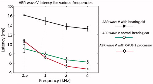 Figure 50. ABR waves V latencies across four different frequencies in normal hearing participants wearing a hearing aid (black curve), in normal hearing ears of SSD CI recipients without a hearing aid (green curve: nature), and the implanted ears [Citation42] of those CI recipients (red curve: MED-EL implantees). Reproduced by permission of Elsevier B.V.