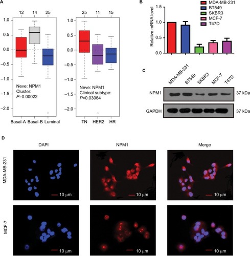 Figure 3 Expression of NPM1 was distinct in different breast cancer cell lines. (A) NPM1 expression in different molecular subtypes of breast cancer cells using GOBO analysis. (B–C) NPM1 expression levels in various human breast cancer cell lines were tested via RT-PCR (B) and Western blotting (C). (D) Immunofluorescence of MDA-MB-231 and MCF-7 cells stained with anti-NPM1 (red signal).Abbreviations: HR, hormone receptor; TN, triple negative.