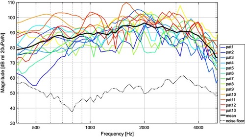 Figure 3 Average nasal sound pressure level based on follow-up data for each patient (in colors) together with the overall mean (black solid line) and the average noise floor (black dotted line).