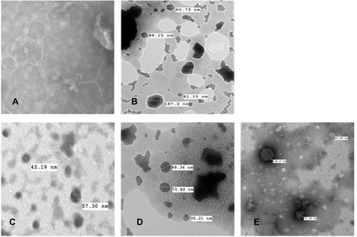 Figure 5 Transmission electron microscopy images of (A) MX-gel, (B) CLP-gel, (C) TFS-gel, (D) FLSQ-gel, (E) FLSD-gel.