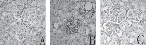 Figure 2. Representative micrographs of immunostaining for ICAM-1 in renal tissue from three groups: (A) seldom specific immunoreactivity in the NC group; (B) strong immunoreactivity for ICAM-1 on the glomerulus and peritubular capillaries (arrow) in DM group; (C) significantly reduced immunoreactivity staining of ICAM-1 on the glomerulus and peritubular capillaries (arrow) in DM + TAU group. Original magnification × 200.