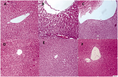 Figure 2. H&E staining of liver tissues isolated from CCl4-exposed rats demonstrated that CCl4 poisoning resulted in excessive formation of fatty acid, necrosis of Kupffer cells around the central vein and netrophil infilteration (B). The ethanol extract at the doses of 200 and 400 mg/kg/d reversed the liver injures by CCl4, towards normal pattern (C and D). The extract at the dose of 100 mg/kg/d did not show a considerable protective effect on the pathological changes induced by CCl4 (E). Examination of the liver sections from the rat treated only with 400 mg/kg/d Stachys pilifera showed normal architecture (F) similar to control group (A).