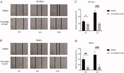 Figure 2. GA-amide inhibited the migration of HUVECs and NhECs. (A,B) Representative images showing scratch width after ECs were treated with 0.2 μM GA-amide for 0, 6, and 12 h. Images were taken under a phase-contrast microscope at 100× magnitude. Scale bar, 200 μm. (C,D) Quantitative analysis of (A) and (B). Data are presented as the mean ± S.D., and samples were assayed in triplicate. Significant differences between individual groups were determined using two-way RM ANOVA with Sidak’s multiple comparisons test. **p < 0.01; ***p < 0.001.