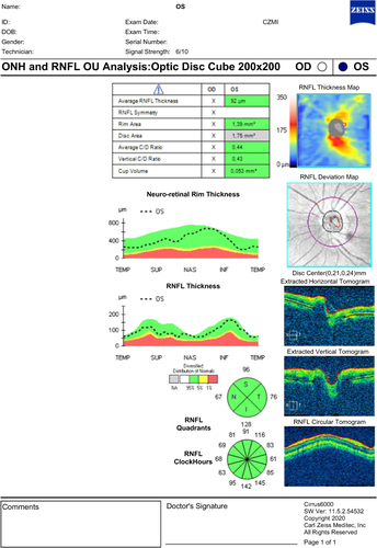 Figure 2 OCT sample.