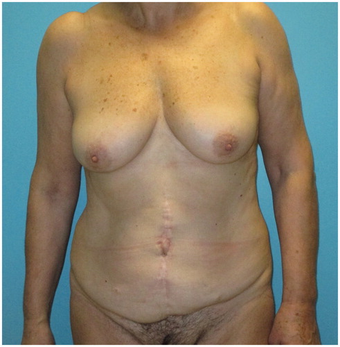 Figure 1. Preoperative front view.