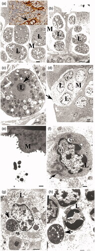 Figure 4. Transmission electron microscopic features of M cells were shown during intestinal inflammation induced by high and low dietary fibre diets. M cells had characteristic features of apoptosis with an extremely thin cytoplasm and vacuole (open arrow) and chromatin condensation of the lymphocyte nucleus (L) in the M cell pocket (arrowhead) (bar, 2 µm in d). Insert: immunolabeling of vimentin results in the swelling of M cells. Higher magnification (c) shows the disruption of the chromatin of lymphocyte cells. M cells appear to be pushed close to the surface of the intestine (bar, 500 nm in e). f–h represent the lymphocyte cytoplasm in the M cell pocket vesicles (bar, 500 nm in f) and multivesicles (g, h; bar, 2 µm in g and 500 nm in h).