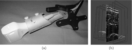 Figure 2. (a) The DRB attached to the ultrasound probe. (b) Automatically segmented bone contours in anatomical space.