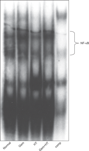 Figure 6. Gemcitabine-induced NF-κB was decreased by the combination therapy with heat treatment. The binding activity of NF-κB was assessed after 12 h of gemcitabine treatment or 24 h of heat treatment. AsPC-1 cells were exposed to four kinds of stimuli. The results for no treatment (control) (lane 1), treatment with gemcitabine alone (30 μM) (lane 2), treatment with heat alone (43°C, 1 h) (lane 3), and heat treatment combined with gemcitabine treatment (lane 4) are shown.