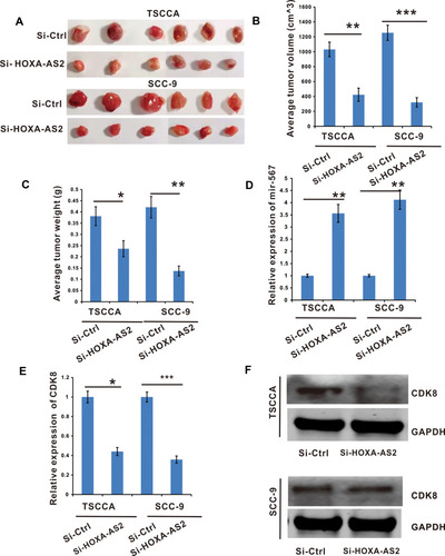 Figure 6 Silencing of lncRNA HOXA-AS2 inhibited OSCC tumor growth by releasing miR-567 to inhibit the expression of CDK8. TSCCA and SCC-9 cells with si-LncRNA HOXA-AS2 or its negative control were injected into nude mice to establish xenograft OSCC tumor models. (A) Images of tumor nodules excised at the end of the study. (B and C) The tumor volume and weight were analyzed. (D) The miR-567 expression in tumor tissues. (E) The CDK8 mRNA expression in the node mice tumor tissues were determined by RT-qPCR. (F) The CDK8 protein level in the node mice tumor tissues were determined by Western Blot. *Means P <0.05, **Means P<0.01, and ***Means P<0.001.