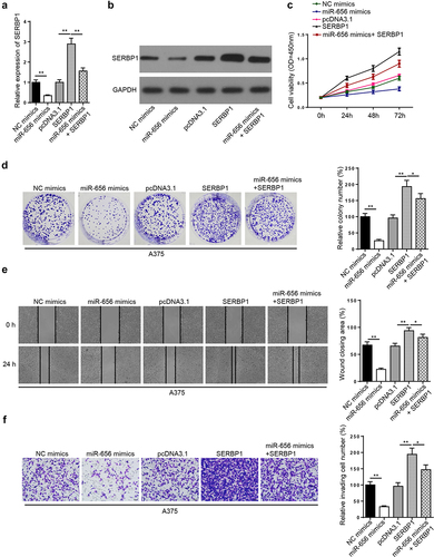 Figure 6. miR-656-3p impedes melanoma cell viability, migration, and invasion via SERBP1