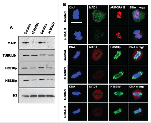 Figure 4. MAD1 has a limited role in the regulation of AURORA B-mediated mitotic functions. (A). HeLa cells were transfected with control or MAD1 siRNA for 48 hours, followed by immunoblotting with anti-MAD1 and phosphorylation specific antibodies against histone H3 residues serine 10 and serine 28. Western blotting with histone H3 and TUBULIN antibodies were performed as controls. (B). Immunofluorescence analysis of control and MAD1 siRNA transfected HeLa cells was performed with the indicated antibodies to visualize Aurora B localization and the phosphorylation status of histone H3 S10 and S28 residues during metaphase. DNA was stained with Hoechst. Scale bar is 10 microns.