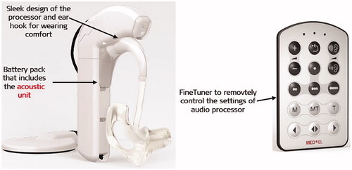 Figure 19. DUET-2™ EAS™ audio processor with its remote control FineTuner™ (image courtesy of MED-EL).