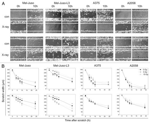 Figure 3. Influence of irradiation on motiliy, measured by scratch assay. (A) Representative images of cells directly (0 h) or 10 h after scratch in controls (con) or cells irradiated with 10 Gy (X-ray). Upper panel: cells 1 d after irradiation, lower panel: cells 7 d after irradiation. (B) Measured scratch widths. Upper panel: cells were seeded, irradiated with 5 or 10 Gy or remained untreated, cultured overnight and the scratch was generated. Scratch width at five sites on a particular position was measured after 4, 6, 8, 10 and 24 h. Lower panel: cells were irradiated with 5 or 10 Gy and cultured for another 6 d. Treated and untreated cells were seeded and cultured overnight before starting with the assay as described above. Three independent experiments were performed. Symbols represent means ± SEM, (p ≤ 0.05), *, vs. 5 and 10 Gy; #, vs. 5 Gy; §, vs. 10 Gy. ANOVA, Bonferroni post hoc method.