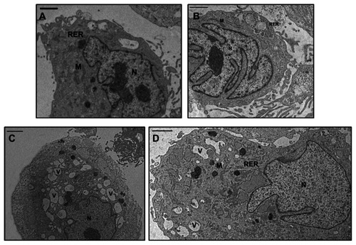 Figure 2 TEM micrographs of human OA chondrocytes. (A) Basal conditions: The cell shows an euchromatic nucleus (N), a reduction in cytoplasmic components, such as rough endoplasmic reticulum (RER) and mitochondria (M). The plasma membrane presents cytoplasmic processes. (B) Incubation with REAC TO-RNG: The nucleus (N) is euchromatic; the cytoplasm shows a significant increase of the presence of rough endoplasmic reticulum and mitochondria (M). (C) Incubation with IL-1b: The cytoplasm shows a diffuse vacuolization (V) and it contains a reduced quantity of typical organelles, such as Golgi bodies, rough endoplasmic reticulum and mitochondria (M). (D) Incubation with REAC TO-RNG + IL-1β: The cell partially restores its morphology. The nucleus (N) is euchromatic, the cytoplasm shows a restored organization: a much reduced number of vacuoles (V) is present, rough endoplasmic reticulum is abundant and mitochondria (M) are well shaped. The plasma membrane presents many cytoplasmic processes. Bar = 1μm.