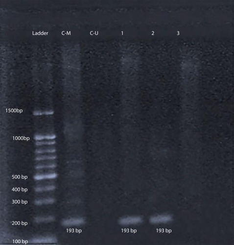 Figure 2 Gel electrophoresis of amplified products with M-P53 for determination of P53 methylation status. L: represents the 100-bp ladder; CM: methylated commercial P53 control DNA (193 bp); CU: unmethylated commercial P53 control DNA; 1 & 2 reveal methylated P53 DNA patient samples; and 3: represents unmethylated P53 DNA patient samples.