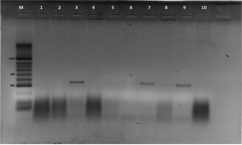 Fig. 4 Results after capillary electrophoresis using primer FOV_BT_SNP_R3 and ABI Prism SNaPshot Multiplex Kit (Applied Biosystems, Foster City, CA). Peaks marked additionally by green color, showing a presence of SNP (nucleotide A) and detect race 3 specifically.