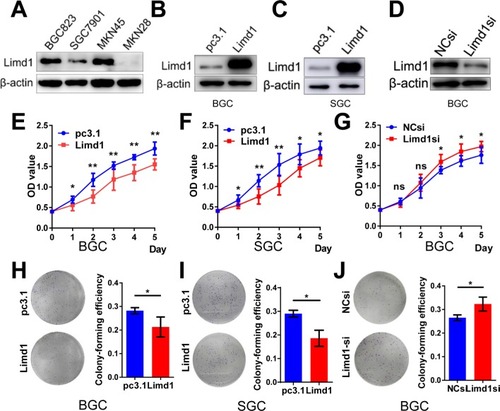 Figure 2 LIMD1 impedes tumor growth in GC cell lines.Notes: (A) Western blot shows the expression level of LIMD1 in four GC cell lines, including BGC823, SGC7901, MKN45, and MKN28, (B, C) Western blot shows the LIMD1 expression levels in BGC823 and SGC7901 cells transfected with LIMD1 overexpression vector and empty vector. (D) LIMD1 expression levels in BGC823 cells transfected with LIMD1si and NCsi. (E–G). Proliferation curves of BGC823 and SGC7901 cells transfected with LIMD1 overexpression vector (E and F) and LIMD1-siRNA (G). (H–J). Colony formation assay of BGC823 and SGC7901 cells transfected with LIMD1 overexpression vector (H and I) and LIMD1-siRNA (J). The representing plates are shown on the left, and the quantification bars are shown on the right. Each panel represents at least three independent experiments. *P<0.05; **P<0.01. LIMD1, LIMD1 overexpression vector; pc3.1, empty vector.Abbreviations: GC, gastric cancer; LIMD1si, LIMD1-siRNA; NCsi, negative control siRNA; NS, no significance.