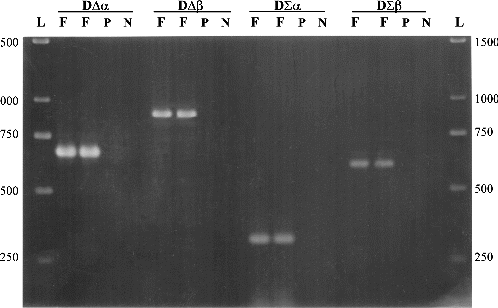 Figure 1. Detection of bacterial DNA in plant tissues, using four sets of primers. F is an amplified fragment (in duplicated reactions) at different positions of the bacterial 16S rDNA gene. P is the control template using pure plant DNA and N is the negative control with no DNA template. L is 1 kb ladder (GeneRulerTM, MBI Fermentas, Lithuania).