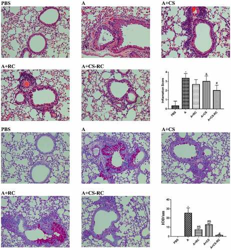 Figure 4. Histopathological analysis of the lung tissues