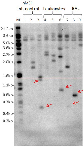 Figure 1 Representative USTELA. 1: Marker, 2–4: hMSC internal control at different passages (p X, X, X), 5–7: Leukocyte samples, 8–10: BAL samples. Red arrows indicate the presence of ultra-short telomeres that are below the threshold of 1.5kb shown as red horizontal line.